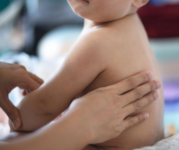 Scutece hipoalergenice: ce înseamnă și când sunt necesare pentru bebeluși